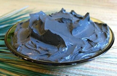 Therapeutic mud is very useful for prostatitis, but is not indicated for all patients
